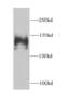 FA Complementation Group A antibody, FNab03003, FineTest, Western Blot image 
