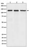 Integrin Subunit Alpha V antibody, M01561, Boster Biological Technology, Western Blot image 