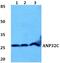 Acidic Nuclear Phosphoprotein 32 Family Member C antibody, PA5-37020, Invitrogen Antibodies, Western Blot image 
