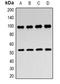 Dickkopf WNT Signaling Pathway Inhibitor 4 antibody, orb378033, Biorbyt, Western Blot image 