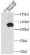Disabled homolog 2-interacting protein antibody, FNab02229, FineTest, Immunoprecipitation image 