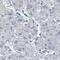 GTPase KRas antibody, HPA049830, Atlas Antibodies, Immunohistochemistry paraffin image 