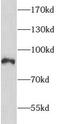 Rho GTPase-activating protein 10 antibody, FNab00546, FineTest, Western Blot image 