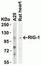 DExD/H-Box Helicase 58 antibody, NBP1-76732, Novus Biologicals, Western Blot image 