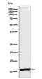 Vesicle Associated Membrane Protein 3 antibody, M02464-1, Boster Biological Technology, Western Blot image 