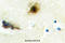 Phosphofructokinase, Liver Type antibody, A06447-1, Boster Biological Technology, Immunohistochemistry paraffin image 