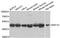 Eukaryotic Translation Elongation Factor 1 Gamma antibody, LS-B14883, Lifespan Biosciences, Western Blot image 