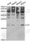 Leptin antibody, A5673, ABclonal Technology, Western Blot image 