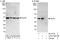 Elongator Acetyltransferase Complex Subunit 4 antibody, A303-704A, Bethyl Labs, Immunoprecipitation image 
