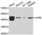 JunB Proto-Oncogene, AP-1 Transcription Factor Subunit antibody, A12979, ABclonal Technology, Western Blot image 