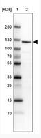 RNA Binding Motif Protein 25 antibody, NBP1-83418, Novus Biologicals, Western Blot image 