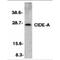 Cell Death Inducing DFFA Like Effector A antibody, TA305987, Origene, Western Blot image 