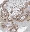 Zinc Finger Protein 354B antibody, NBP1-82064, Novus Biologicals, Immunohistochemistry paraffin image 