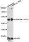 Mitogen-Activated Protein Kinase Kinase 1 antibody, AP0064, ABclonal Technology, Western Blot image 