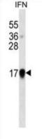 Interferon alpha-1/13 antibody, abx025284, Abbexa, Western Blot image 