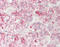 Malate dehydrogenase 2, mitochondrial antibody, LS-B12050, Lifespan Biosciences, Immunohistochemistry paraffin image 
