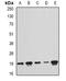 Peptidyl-TRNA Hydrolase 2 antibody, orb341094, Biorbyt, Western Blot image 