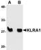 T-cell surface glycoprotein YE1/48 antibody, orb75134, Biorbyt, Western Blot image 