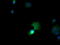 Cancer/Testis Antigen 1B antibody, LS-C174583, Lifespan Biosciences, Immunofluorescence image 