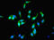Phosphoenolpyruvate carboxylase antibody, LS-B12266, Lifespan Biosciences, Immunofluorescence image 