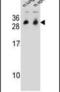 Cytochrome B561 Family Member D1 antibody, PA5-24523, Invitrogen Antibodies, Western Blot image 