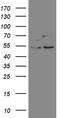 SS18 Subunit Of BAF Chromatin Remodeling Complex antibody, LS-C792268, Lifespan Biosciences, Western Blot image 