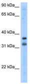 Potassium Channel Regulator antibody, TA338800, Origene, Western Blot image 