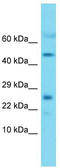 Mitochondrial Ribosomal Protein L22 antibody, TA343252, Origene, Western Blot image 