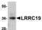 Leucine Rich Repeat Containing 19 antibody, TA306940, Origene, Western Blot image 