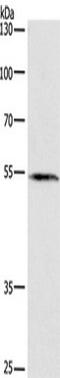 BLK Proto-Oncogene, Src Family Tyrosine Kinase antibody, TA349715, Origene, Western Blot image 