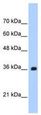 TRNA Selenocysteine 1 Associated Protein 1 antibody, TA343862, Origene, Western Blot image 