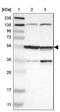 Nuclear receptor ROR-beta antibody, NBP1-82532, Novus Biologicals, Western Blot image 