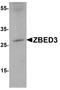 Zinc Finger BED-Type Containing 3 antibody, A14001-1, Boster Biological Technology, Western Blot image 