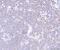 Phospholipase C Gamma 2 antibody, A03572-1, Boster Biological Technology, Immunohistochemistry paraffin image 