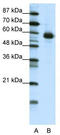 Nuclear Factor, Interleukin 3 Regulated antibody, TA343536, Origene, Western Blot image 