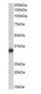 CD74 Molecule antibody, orb195358, Biorbyt, Western Blot image 