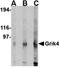  antibody, orb74910, Biorbyt, Western Blot image 