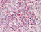 Matrix Metallopeptidase 9 antibody, 51-128, ProSci, Immunohistochemistry frozen image 