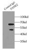 Pantothenate kinase 2, mitochondrial antibody, FNab06134, FineTest, Immunoprecipitation image 