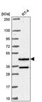 RFX Family Member 8, Lacking RFX DNA Binding Domain antibody, PA5-66278, Invitrogen Antibodies, Western Blot image 