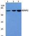 Sentrin-specific protease 2 antibody, PA5-75184, Invitrogen Antibodies, Western Blot image 