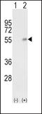 Haptoglobin antibody, 63-707, ProSci, Western Blot image 