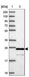 Chromosome 6 Open Reading Frame 203 antibody, NBP2-14420, Novus Biologicals, Western Blot image 