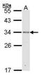 Replication Protein A2 antibody, GTX101765, GeneTex, Western Blot image 