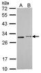 Sdh1 antibody, GTX104628, GeneTex, Western Blot image 