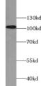 Actinin Alpha 1 antibody, FNab00322, FineTest, Western Blot image 