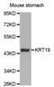 Keratin 19 antibody, abx000632, Abbexa, Western Blot image 