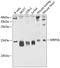 Mitochondrial Ribosomal Protein S6 antibody, GTX65992, GeneTex, Western Blot image 