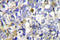 Sterol 26-hydroxylase, mitochondrial antibody, LS-C176853, Lifespan Biosciences, Immunohistochemistry frozen image 