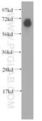 Prothrombinase antibody, 11827-1-AP, Proteintech Group, Western Blot image 